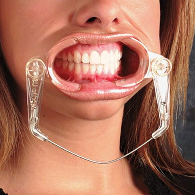 Free Access II Lip and Cheek Retractor